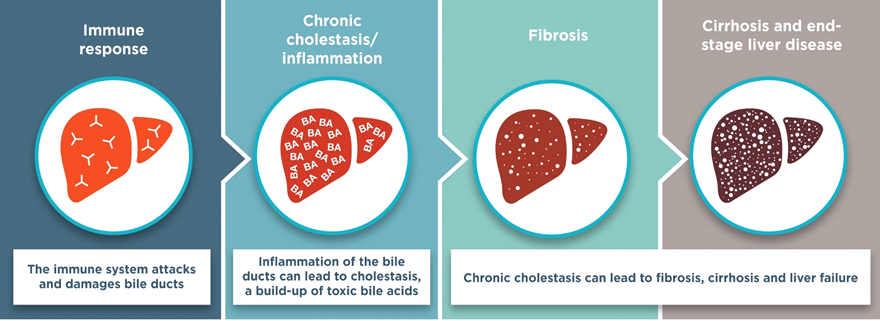 Researchers Probe Role of Prom-1 in Liver Disease