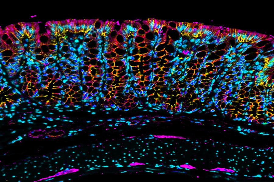 Technical Tips for Antigen Retrieval