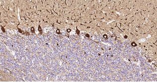 Immunohistochemical analysis of paraffin embedded
human cerebellum tissue slide using IHC0182H
(Human Tubb3 IHC Kit).
