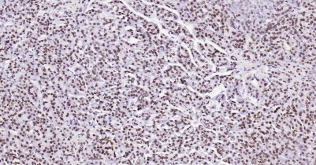 Immunohistochemical analysis of paraffin embedded
human pancreas tissue slide using IHC0183H
(Human Lamin B IHC Kit).