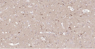 Immunohistochemical analysis of paraffin embedded
human brain tissue slide using IHC0188H (Human
STMN1 IHC Kit).