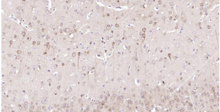 Immunohistochemical analysis of paraffin embedded
mouse brain tissue slide using IHC0188M (Mouse
STMN1 IHC Kit).