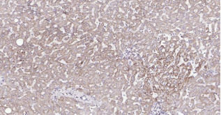 Immunohistochemical analysis of paraffin embedded
human liver tissue slide using IHC0189H (Human
COX4I1 (Mitochondrial Loading Control) IHC Kit).