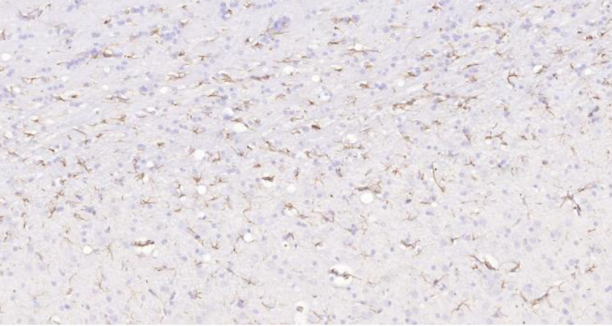Immunohistochemical analysis of paraffin embedded Rat brain tissue slide using IHC0101R (Rat GFAP IHC Kit).