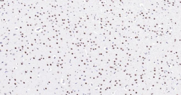 Immunohistochemical analysis of paraffin embedded mouse brain tissue slide using IHC0105M (Mouse MYBL2 IHC Kit).