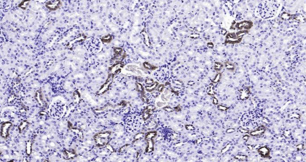 Immunohistochemical analysis of paraffin embedded mouse kidney tissue slide using IHC0106M (Mouse Calbindin IHC Kit).