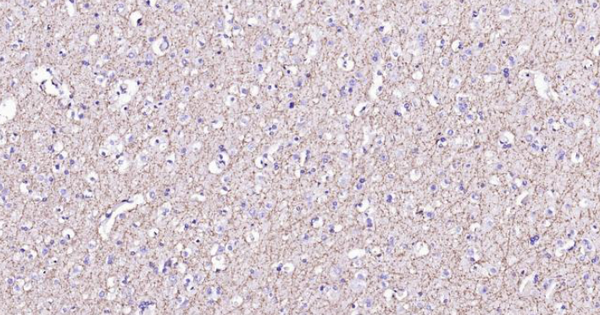 Immunohistochemical analysis of paraffin embedded human brain tissue slide using IHC0107H (Human MBP IHC Kit).