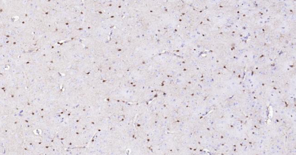 Immunohistochemical analysis of paraffin embedded mouse brain tissue slide using IHC0110M (Mouse S100B IHC Kit).