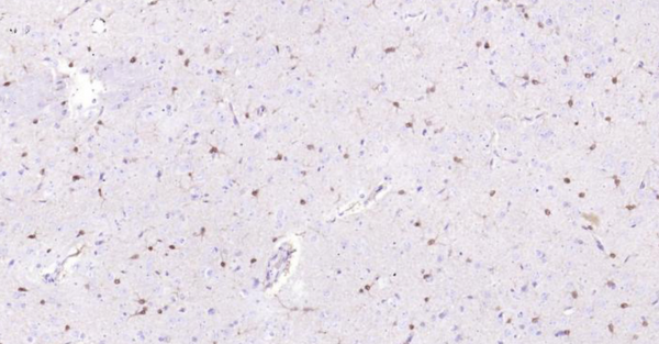 Immunohistochemical analysis of paraffin embedded rat brain tissue slide using IHC0110R (Rat S100B IHC Kit).