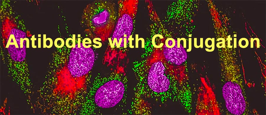 Multiplex Immunofluorescence Staining Facilitates the Understanding of Tumor Immune Microenvironment
