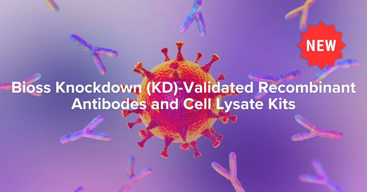 Knockdown (KD)-Validated Recombinant Antibodies and Cell Lysate Kits