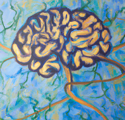 Understanding Neurodevelopmental Disorders: The Role of Assembloids