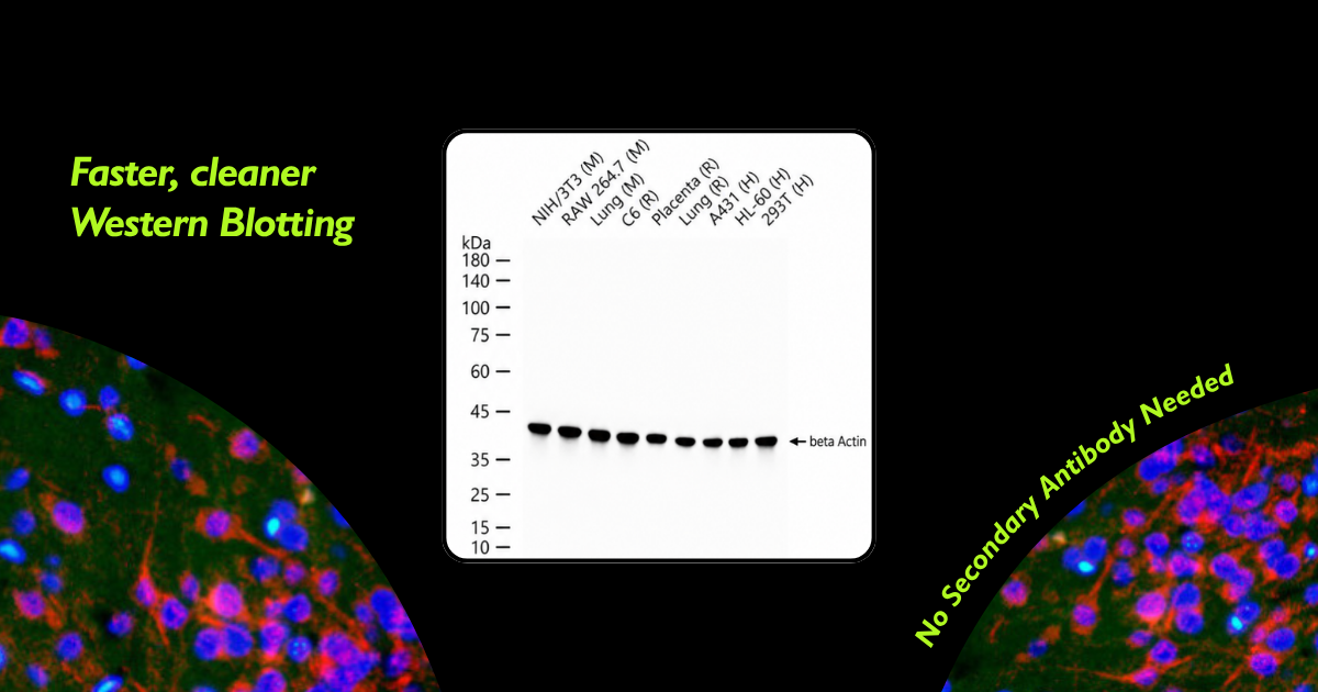 Secondary-Free Western Blot? Why Direct-Labeled Primaries Are Worth a Try