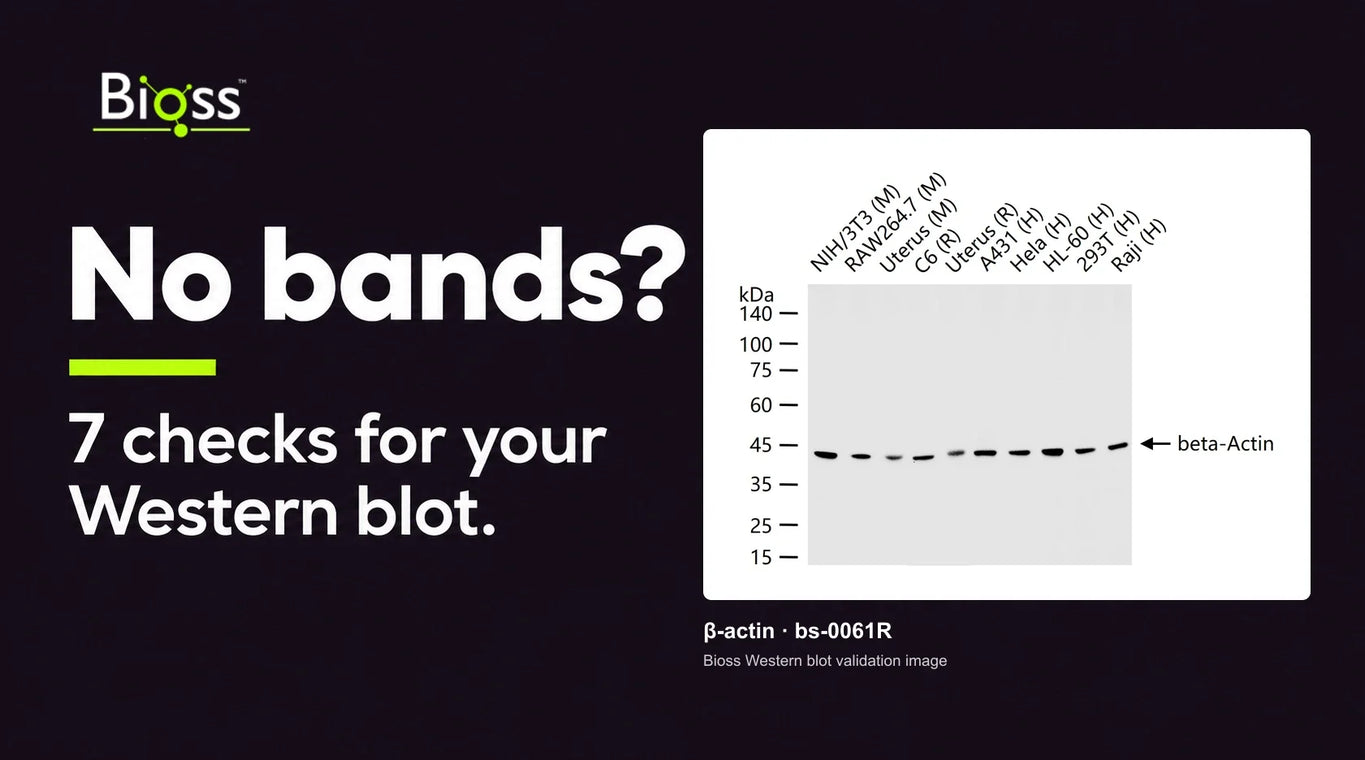 No Bands on Your Western Blot? 7 Checks to Find the Cause