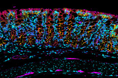 Technical Tips for Antigen Retrieval