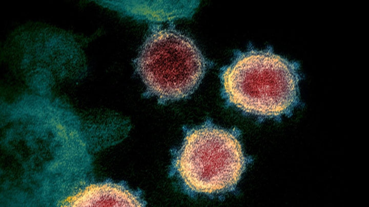 SARS-CoV-2 genetic information may integrate into human chromosomes