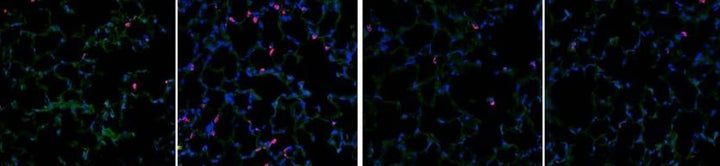 Our Comprehensive Guide to Performing Double Immunofluorescence