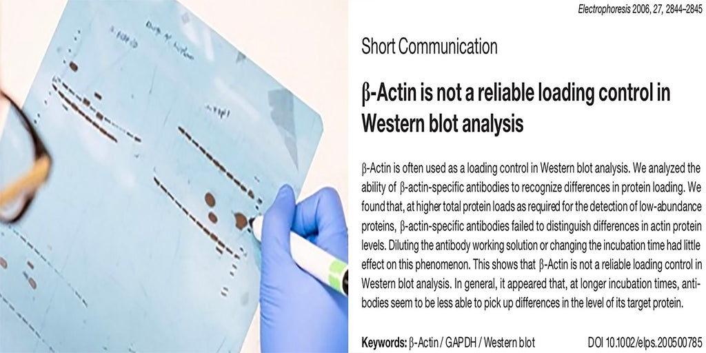 How to select loading controls for Western Blots?