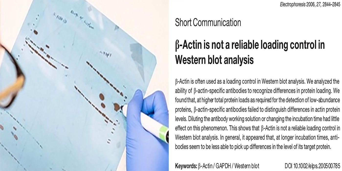 How to select loading controls for Western Blots?
