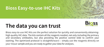 Frequently Asked Questions about Protein Lyophilization and Reconstitution