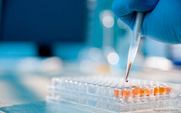 5 Questions to Ask Before Purchasing an Antibody