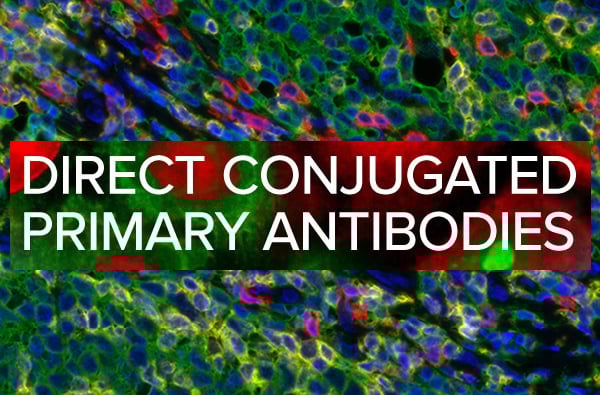 Why are labeled primary antibodies becoming popular for multiplexing?