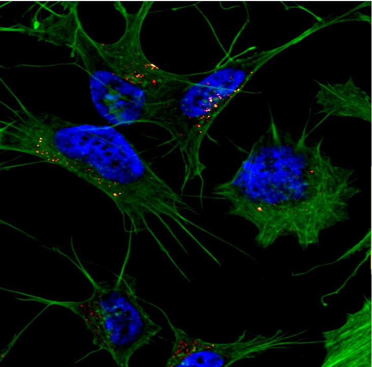 AŒ≤ accumulation, the cause or effect of Alzheimer disease?