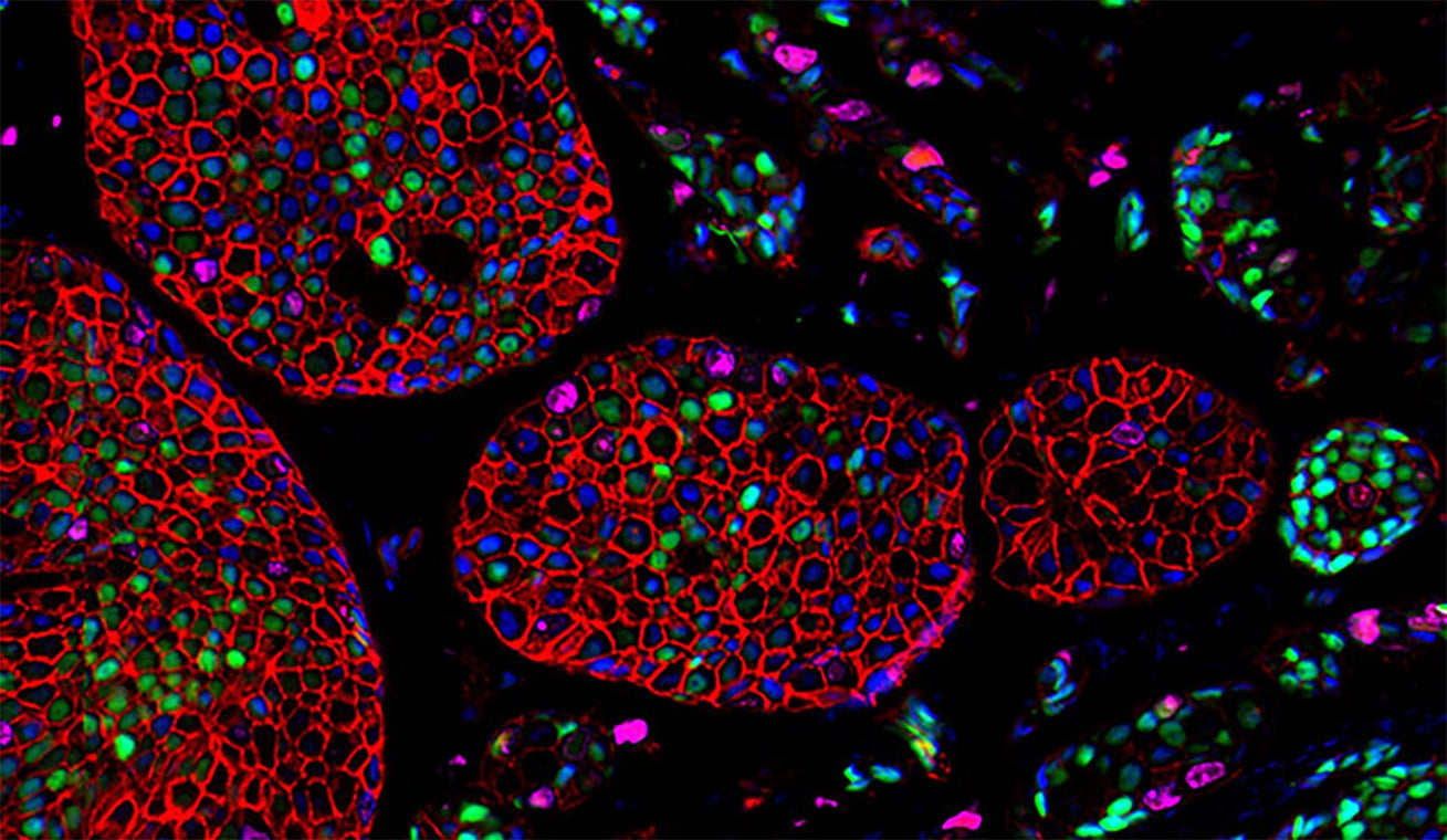 Why do many researchers prefer polyclonal antibodies for an IHC/IF assay?