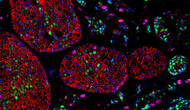 Why do many researchers prefer polyclonal antibodies for an IHC/IF assay?
