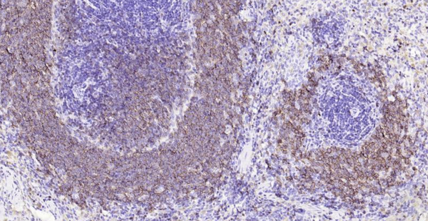 Mouse CD20 Ready-To-Use IHC Kit – Bioss