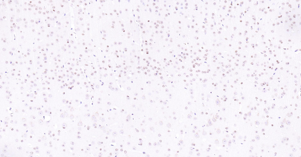 Immunohistochemical analysis of paraffin embedded mouse brain tissue slide using IHC0128M (Mouse ATF4 IHC Kit).
