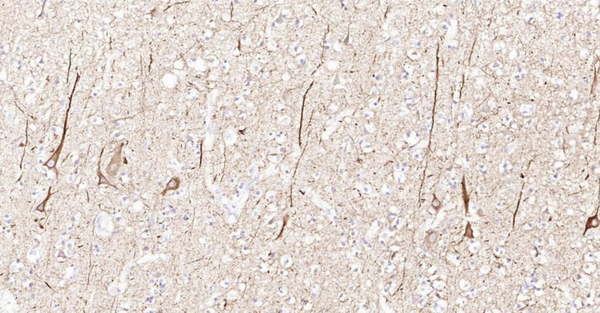 Immunohistochemical analysis of paraffin embedded human brain tissue slide using IHC0129H (Human NF-L IHC Kit).