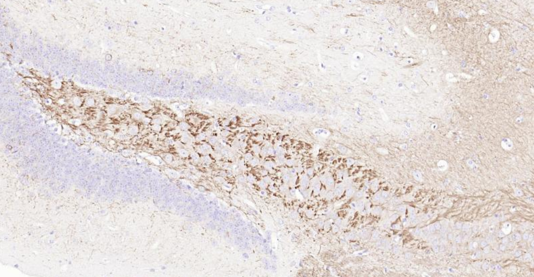 Immunohistochemical analysis of paraffin embedded mouse brain tissue slide using IHC0129M (Mouse NF-L IHC Kit).