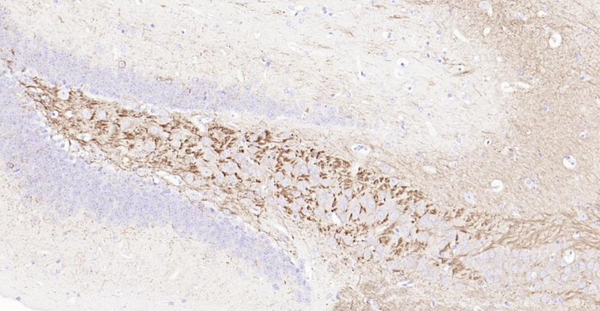 Immunohistochemical analysis of paraffin embedded mouse brain tissue slide using IHC0129M (Mouse NF-L IHC Kit).