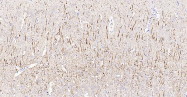 Immunohistochemical analysis of paraffin embedded rat brain tissue slide using IHC0129R (Rat NF-L IHC Kit).