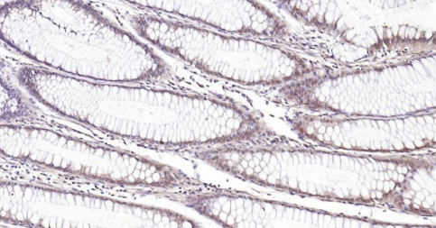 Immunohistochemical analysis of paraffin embedded human colon tissue slide using IHC0134H (Human LKB1 IHC Kit).