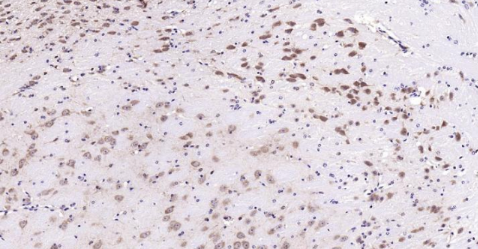 Immunohistochemical analysis of paraffin embedded mouse brain tissue slide using IHC0134M (Mouse LKB1 IHC Kit).