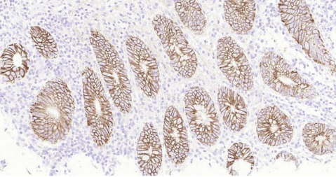 Immunohistochemical analysis of paraffin embedded human appendix tissue slide using IHC0139H (Human ATP1A1 IHC Kit).