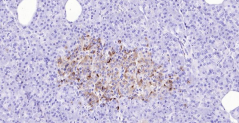 Immunohistochemical analysis of paraffin embedded human pancreas tissue slide using IHC0141H (Human TIMP1 IHC Kit).