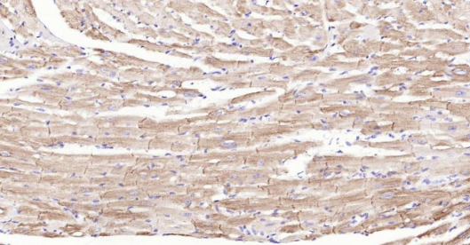 Immunohistochemical analysis of paraffin embedded mouse heart tissue slide using IHC0143M (Mouse Desmin IHC Kit).