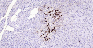 Immunohistochemical analysis of paraffin embedded
human pancreas tissue slide using IHC0179H
(Human Chromogranin B IHC Kit).