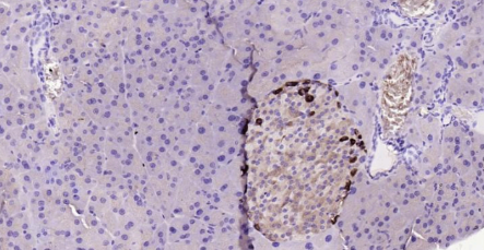Immunohistochemical analysis of paraffin embedded
mouse pancreas tissue slide using IHC0179M
(Mouse Chromogranin B IHC Kit).