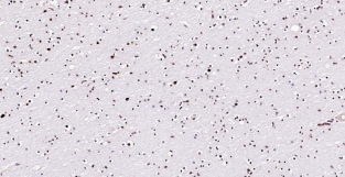 Immunohistochemical analysis of paraffin embedded
human brain tissue slide using IHC0180H (Human
BRD7 IHC Kit).