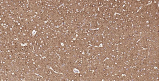 Immunohistochemical analysis of paraffin embedded
mouse brain tissue slide using IHC0182M (Mouse
Tubb3 IHC Kit).