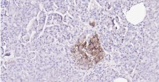 Immunohistochemical analysis of paraffin embedded
human pancreas tissue slide using IHC0185H
(Human Synaptophysin IHC Kit).