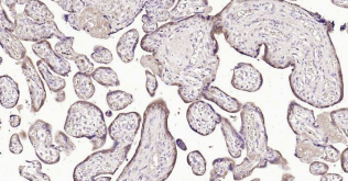 Immunohistochemical analysis of paraffin embedded
human placenta tissue slide using IHC0187H
(Human HSD3B1+ HSD3B2 IHC Kit).