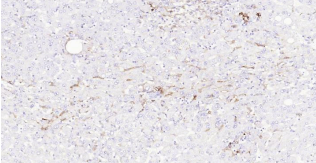 Immunohistochemical analysis of paraffin embedded
human liver tissue slide using IHC0193H (Human
HLA-DR IHC Kit).
