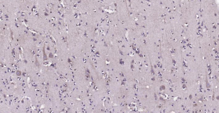 Immunohistochemical analysis of paraffin embedded
human brain tissue slide using IHC0196H (Human
Monoamine Oxidase B IHC Kit).