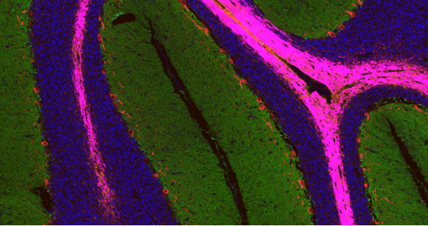 Immunohistochemical analysis of paraffin embedded human brain tissue slide using IHCT003 (Five Color mIHC Fluorescence Kit).