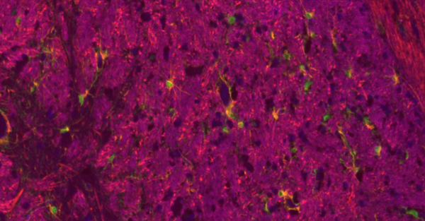 Immunohistochemical analysis of paraffin embedded rat brain tissue slide using IHCT003 (Five Color mIHC Fluorescence Kit).